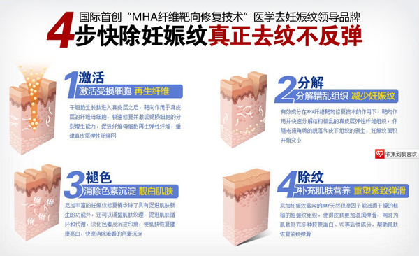 尼加妊娠紋修復(fù)霜