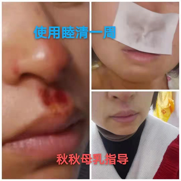 �����澏���N���Æ������M(f��i)�߿ڱ���������(sh��)���a(ch��n)ƷȦ�۟o��(sh��)